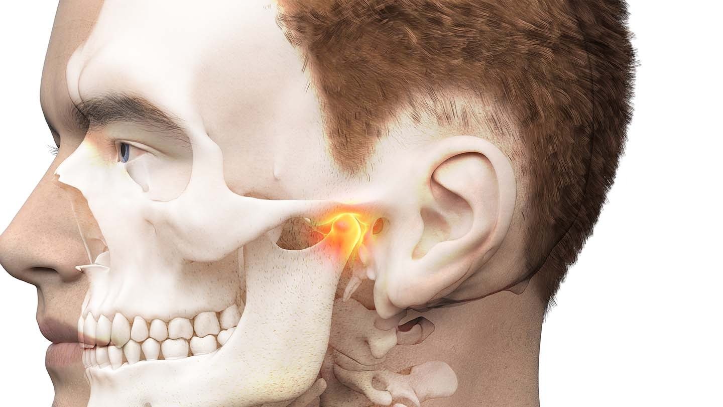Arthrocentesis