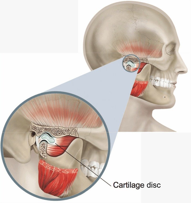 Arthroscopy