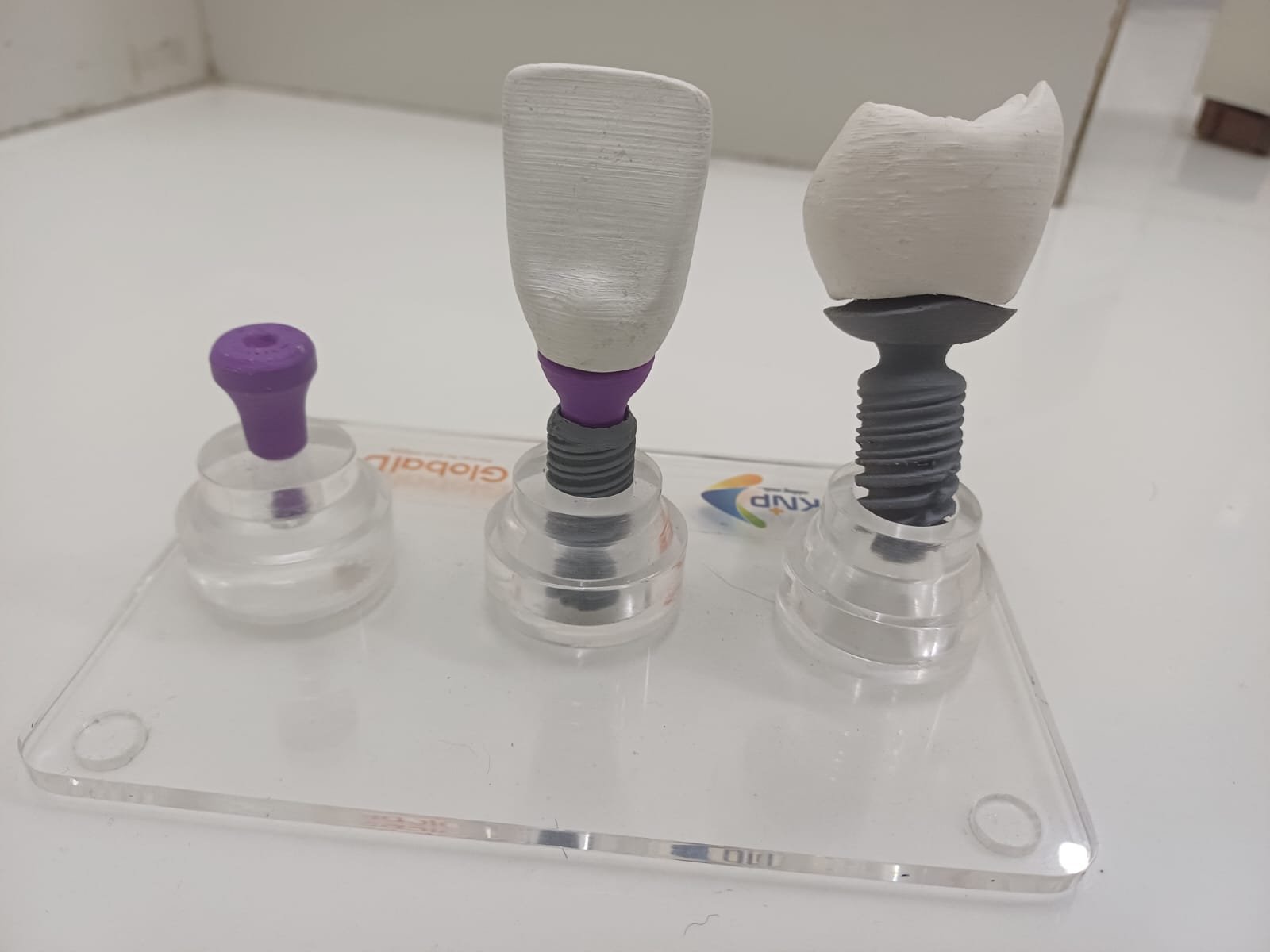 Dental Implants