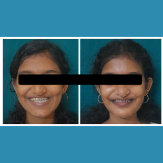 Facial Plastic Surgery