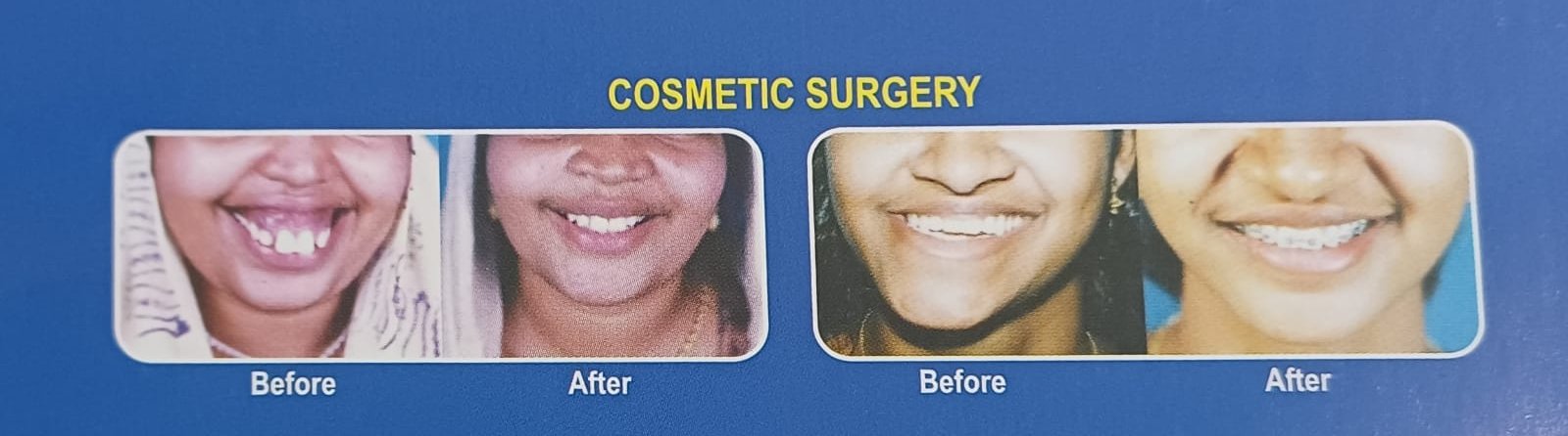 Facial Plastic Surgery