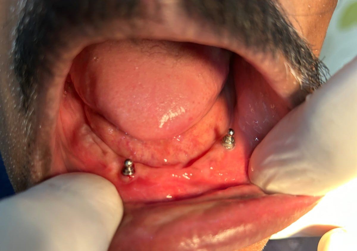 Prosthodontics