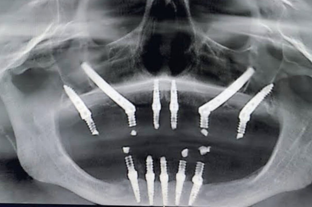 Prosthodontics