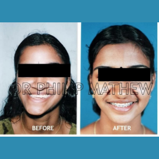 Facial Plastic Surgery